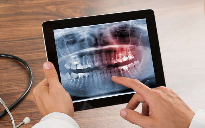 Buford, GA dentist reviewing digital dental x-rays