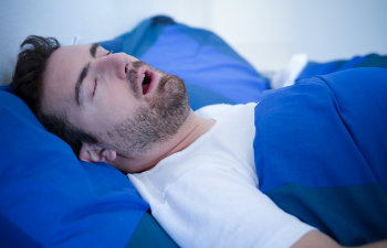 A man snoring and sleeping with an open mouth due to sleep apnea syndrome