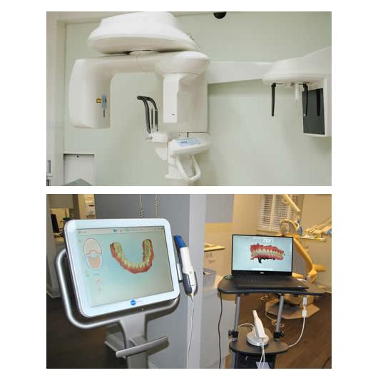 dental implants CBCT Scan Technology