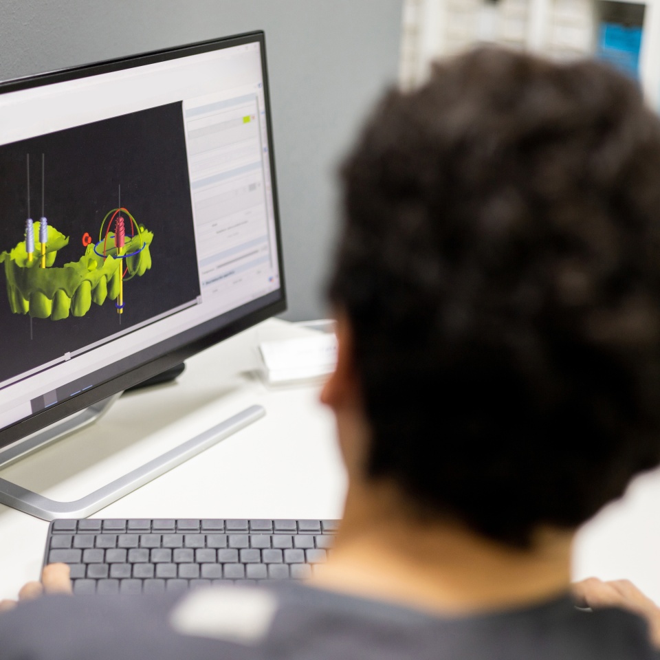 An unrecognizable dentist shows an implant surgery plan on his office monitor through a 3D X-ray. 3D implantology concept.